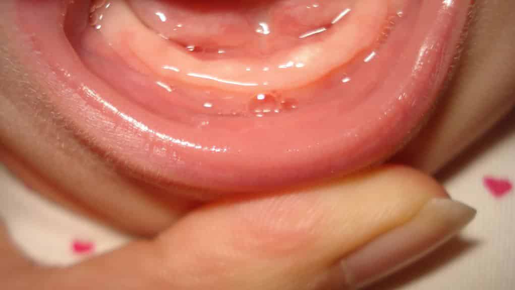 Первые признаки прорезывания зубик